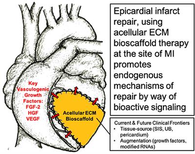 Application of Bioengineered Materials in the Surgical Management of Heart Failure